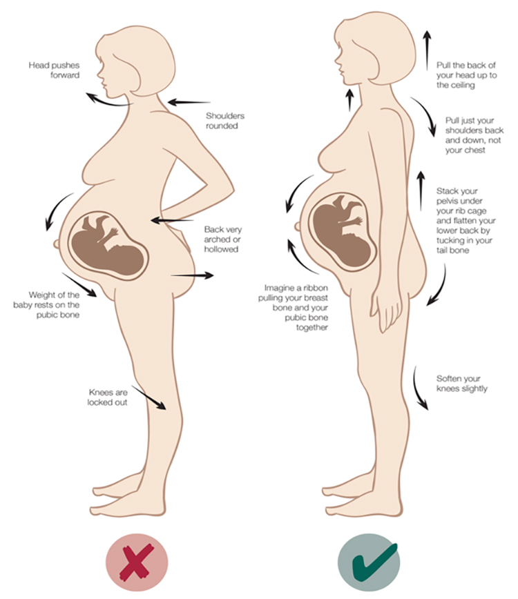 Pregnancy Physio